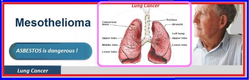 mesothelioma-lawyers-attorneys-usa